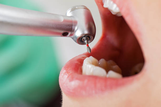 Best Emergency Treatment for Oral Infections in Arthurtown, SC